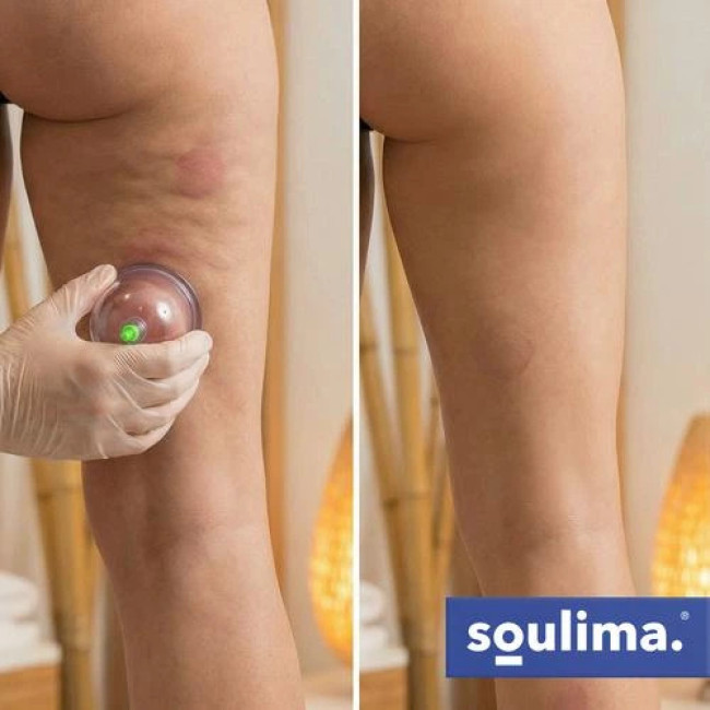 Вакуумні китайські банки Soulima 27292/n